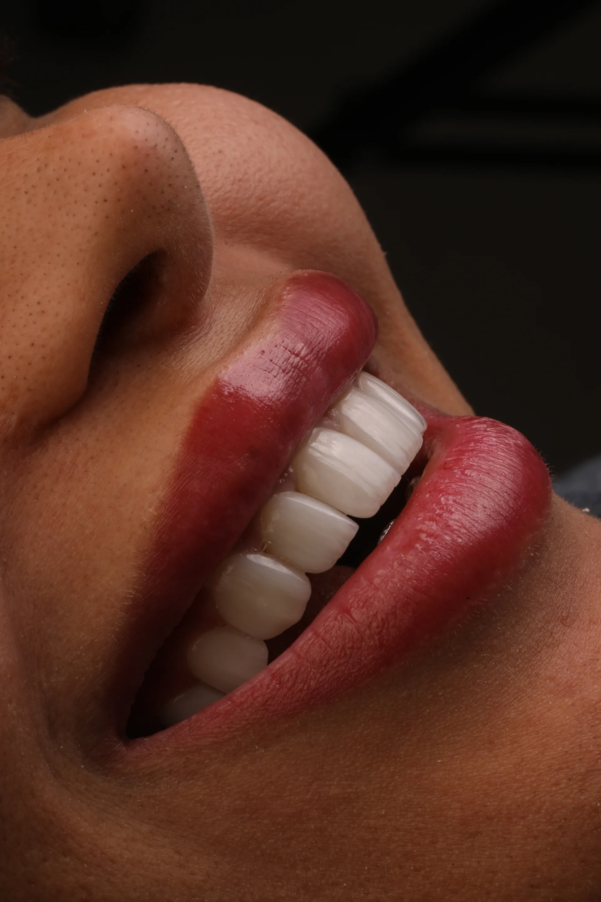 مهارت در سرامیک