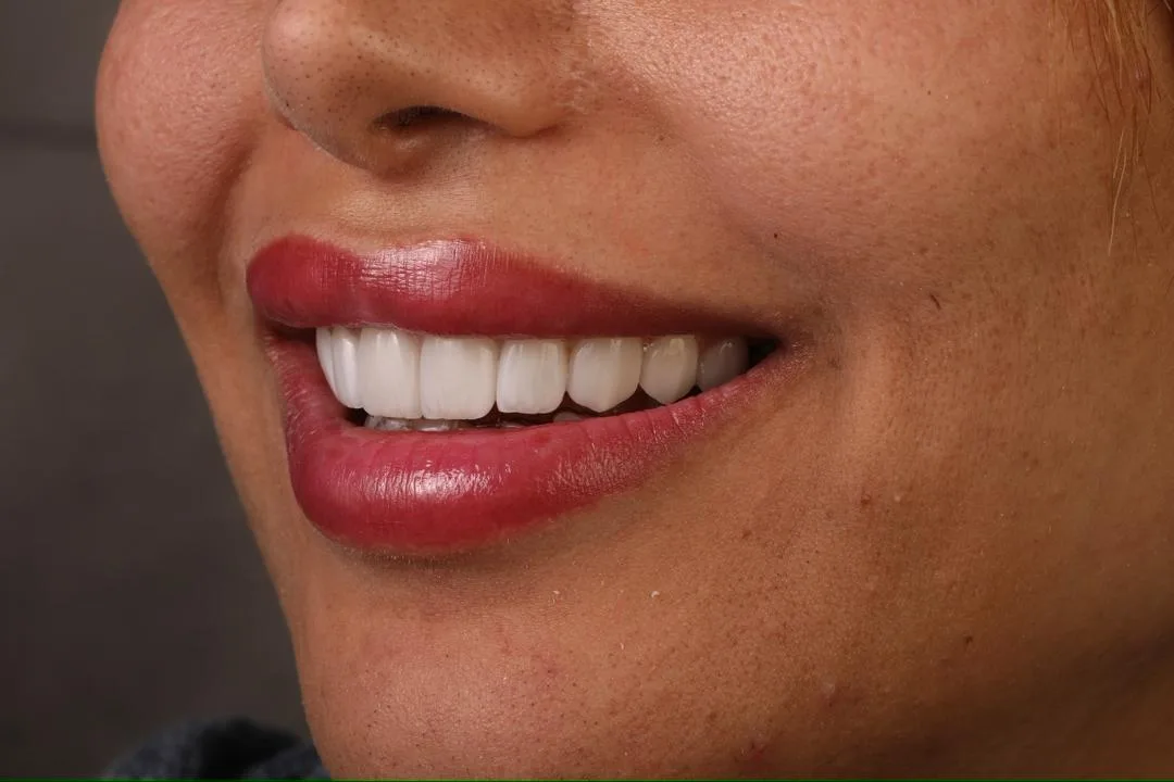 تحول لبخند